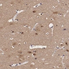 Immunohistochemical staining of human cerebral cortex shows moderate to strong positivity positivity in neurons and neuropil.