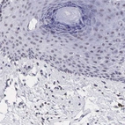 Immunohistochemical staining of human skin shows no positivity in squamous epithelial cells as expected.