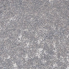 Immunohistochemical staining of human chronic lymphocytic leukemia shows no nuclear positivity in tumor cells as expected.