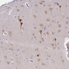 Anti-MLLT11 Antibody