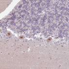 Immunohistochemical staining of human cerebellum shows strong nuclear positivity in Purkinje cells.