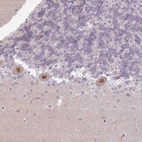 Immunohistochemical staining of human cerebellum shows strong nuclear positivity in Purkinje cells.