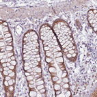 Anti-MLLT11 Antibody