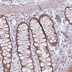 Immunohistochemical staining of human rectum shows strong cytoplasmic positivity in glandular cells.