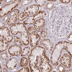 Immunohistochemical staining of human kidney shows strong cytoplasmic positivity in cells in tubules.