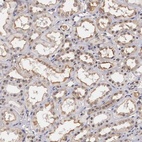 Anti-NR4A2 Antibody