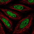 Immunofluorescent staining of human cell line SiHa shows localization to nuclear speckles.