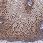 Anti-MAST4 Antibody