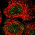 Immunofluorescent staining of human cell line A-431 shows localization to nucleoplasm & cytosol.