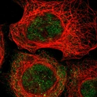 Immunofluorescent staining of human cell line A-431 shows localization to nucleoplasm & cytosol.