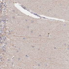 Anti-NREP Antibody