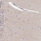 Anti-NREP Antibody