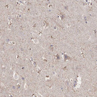 Immunohistochemical staining of human cerebral cortex shows strong cytoplasmic positivity in glial cells, axons and dendrites.