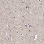 Anti-NREP Antibody