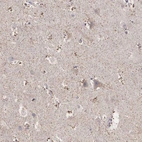 Immunohistochemical staining of human cerebral cortex shows strong cytoplasmic positivity in glial cells, axons and dendrites.
