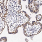 Immunohistochemical staining of human placenta shows strong cytoplasmic positivity in trophoblastic cells.