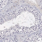 Immunohistochemical staining of human testis shows no positivity in cells in seminiferous ducts as expected.