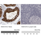 Anti-KIAA1210 Antibody