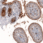 Anti-LGALS3BP Antibody