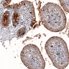 Immunohistochemical staining of human small intestine shows moderate granular cytoplasmic positivity in glandular cells.