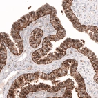 Immunohistochemical staining of human fallopian tube shows strong granular cytoplasmic positivity in glandular cells.