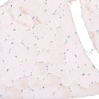 Immunohistochemical staining of human skeletal muscle shows no cytoplasmic positivity in striated muscle fibers as expected.