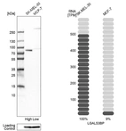 Western blot analysis in human cell lines SK-MEL-30 and MCF-7 using Anti-LGALS3BP antibody. Corresponding LGALS3BP RNA-seq data are presented for the same cell lines. Loading control: Anti-PFN1.