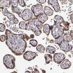 Immunohistochemical staining of human placenta shows moderate cytoplasmic positivity in trophoblastic cells.