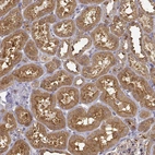 Immunohistochemical staining of human kidney shows moderate cytoplasmic and membranous positivity in cells in tubules.