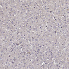 Immunohistochemical staining of human liver shows no positivity in hepatocytes as expected.