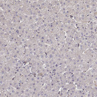 Anti-CRIM1 Antibody