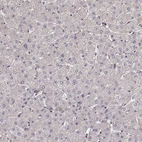 Immunohistochemical staining of human liver shows no positivity in hepatocytes as expected.