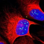 Immunofluorescent staining of human cell line U-2 OS shows localization to nucleoli fibrillar center.