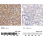 Anti-OTC Antibody