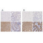 Immunohistochemical staining of human cerebral cortex, kidney, liver and small intestine using Anti-OTC antibody HPA000570 (A) shows similar protein distribution across tissues to independent antibody HPA000243 (B).