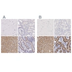 Immunohistochemical staining of human cerebral cortex, kidney, liver and small intestine using Anti-OTC antibody HPA000570 (A) shows similar protein distribution across tissues to independent antibody HPA000243 (B).