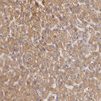 Immunohistochemical staining of human liver shows strong granular cytoplasmic positivity in hepatocytes.