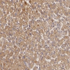 Immunohistochemical staining of human liver shows strong granular cytoplasmic positivity in hepatocytes.