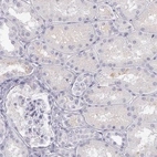 mmunohistochemical staining of human kidney shows no positivity as expected.