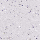 Immunohistochemical staining of human cerebral cortex shows no positivity in neurons as expected.