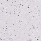 Immunohistochemical staining of human cerebral cortex shows no positivity in neurons as expected.