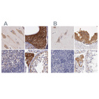 Immunohistochemical staining of human cerebral cortex, epididymis, lymph node and testis using Anti-NSDHL antibody HPA000571 (A) shows similar protein distribution across tissues to independent antibody HPA000248 (B).