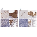 Immunohistochemical staining of human cerebral cortex, epididymis, lymph node and testis using Anti-NSDHL antibody HPA000571 (A) shows similar protein distribution across tissues to independent antibody HPA000248 (B).