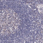 Anti-NSDHL Antibody