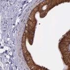 Immunohistochemical staining of human epididymis shows high expression.