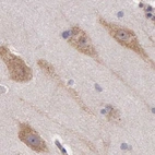 Immunohistochemical staining of human cerebral cortex using Anti-NSDHL antibody HPA000571.