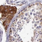 Immunohistochemical staining of human testis using Anti-NSDHL antibody HPA000571.