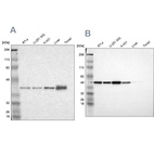 Anti-NSDHL Antibody