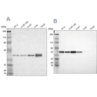 Western blot analysis using Anti-NSDHL antibody HPA000571 (A) shows similar pattern to independent antibody HPA000248 (B).