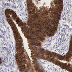 Immunohistochemical staining of human cervix shows strong cytoplasmic positivity in glandular cells.